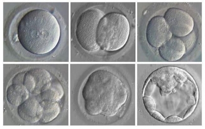 Fertilizao in Vitro